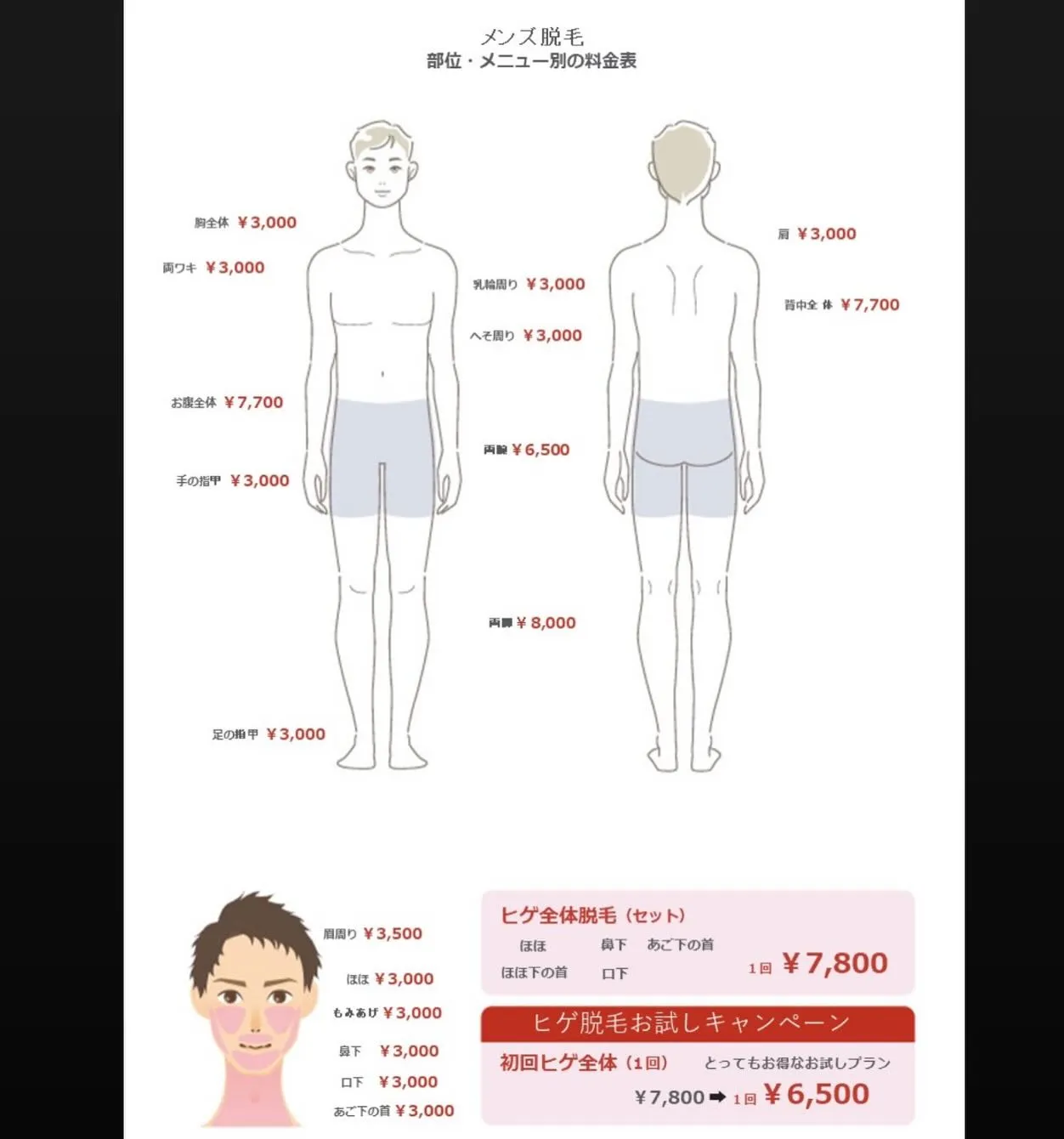 👨🏻‍🦱メンズ脱毛👨🏻‍🦱