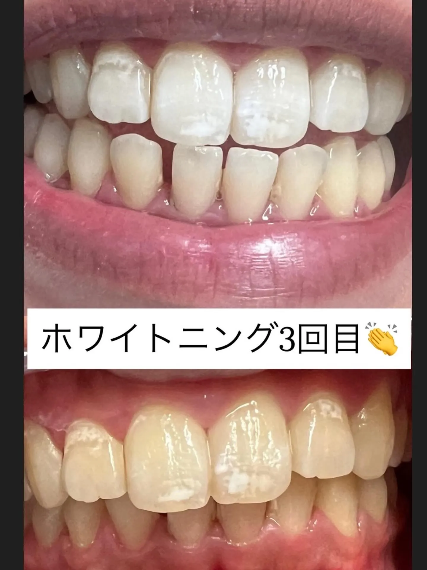 秋冬に蓄えた老廃物などをピーリングやトリートメント、